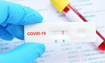 El test de detección de Covid 19 de libre venta en farmacias no tiene demanda.