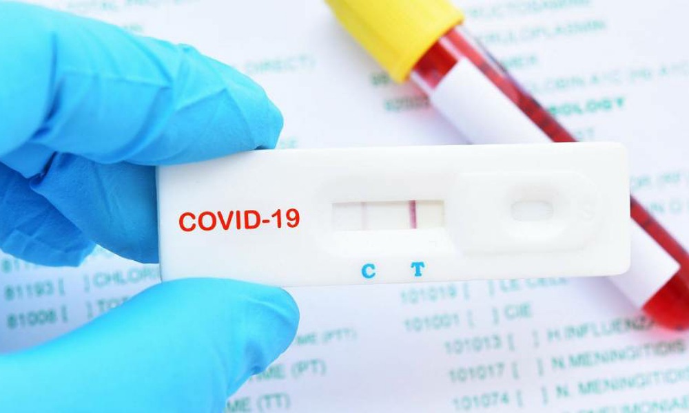 El test de detección de Covid 19 de libre venta en farmacias no tiene demanda.